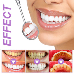 Purple Teeth Whitening Strips Remove Plaque Stains Cleaning Oral Hygiene Bleaching Dental Tools Fresh Breath Brighten Tooth Care